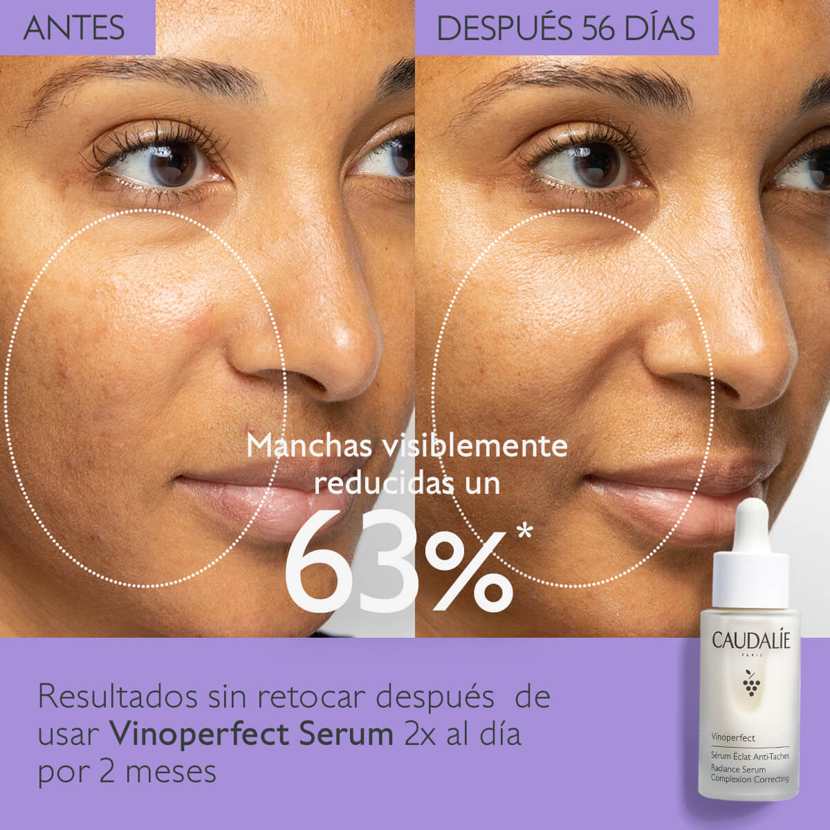 VINOPERFECT SERUM RESPLANDOR ANTI-MANCHAS